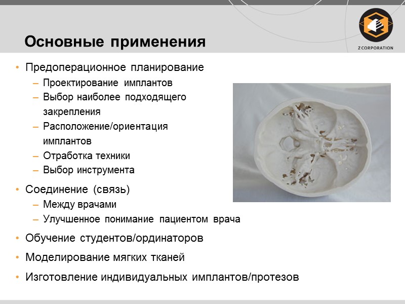 Основные применения Предоперационное планирование Проектирование имплантов Выбор наиболее подходящего   закрепления Расположение/ориентация 